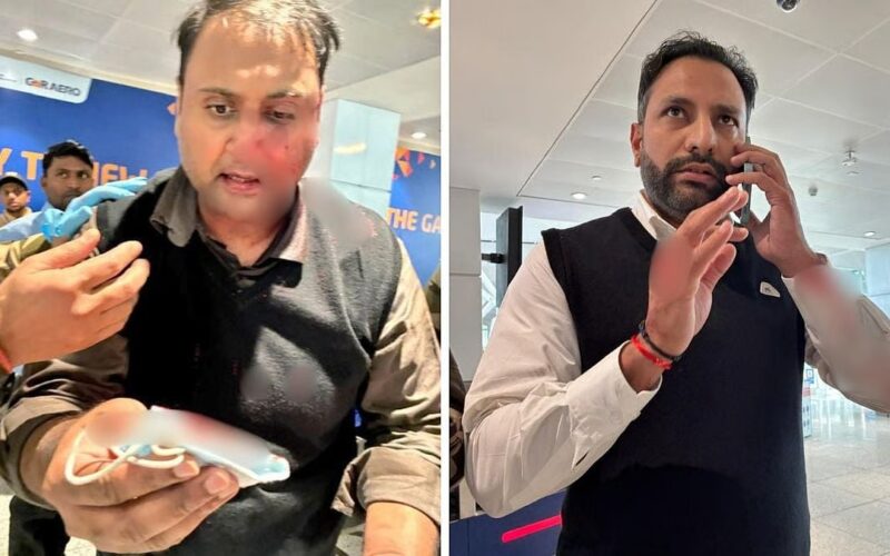 এয়াৰ ইণ্ডিয়াৰ পাইলটৰ আক্ৰমণত ভাগিল যাত্ৰীৰ নাক! দিল্লী বিমানবন্দৰত ভয়ংকৰ কাণ্ড