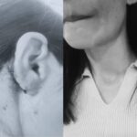 উদ্যানত ফুৰিবলৈ গৈ দুৰ্বৃত্তৰ আক্ৰমণৰ বলি উত্তৰ-পূবৰ দুই যুৱতী, দিল্লীত বৰ্ণবৈষম্যৰ অভিযোগ