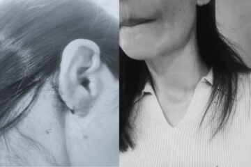 উদ্যানত ফুৰিবলৈ গৈ দুৰ্বৃত্তৰ আক্ৰমণৰ বলি উত্তৰ-পূবৰ দুই যুৱতী, দিল্লীত বৰ্ণবৈষম্যৰ অভিযোগ