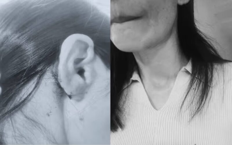 উদ্যানত ফুৰিবলৈ গৈ দুৰ্বৃত্তৰ আক্ৰমণৰ বলি উত্তৰ-পূবৰ দুই যুৱতী, দিল্লীত বৰ্ণবৈষম্যৰ অভিযোগ