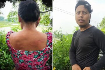 এয়াই যদি প্ৰেম, তেন্তে ঘৃণা কি? যোৰহাটত কঁকালৰ বেল্টেৰে প্ৰেমিকে চিৰাচিৰ কৰিলে প্ৰেয়সীৰ পিঠি