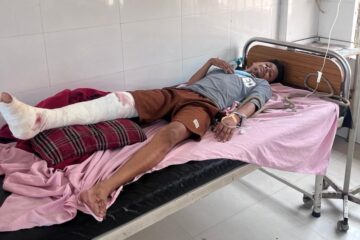আৰক্ষীৰ জিম্মাৰ পৰা পলাবলৈ চেষ্টা কৰি গুলীবিদ্ধ আছিক আলী: ভৰিত লাগিল দুটাকৈ গুলী